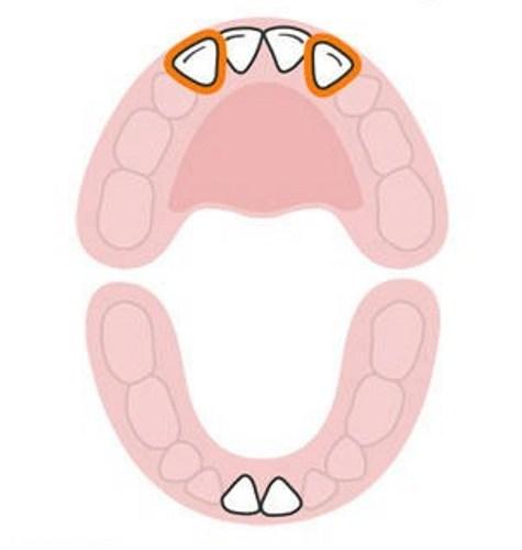  ترتیب رشد دندان های کودک 