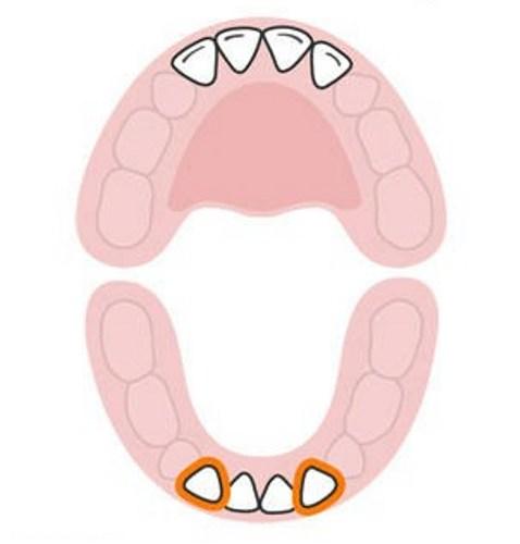  ترتیب رشد دندان های کودک 