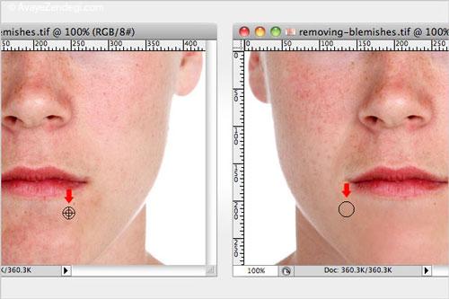  روتوش عکس با فتوشاپ؛ برداشتن لکه های صورت 