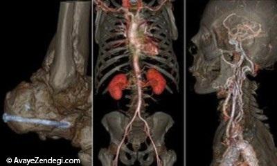  مغز، استخوان و عروق به شکلی که تاکنون ندیده‌اید 