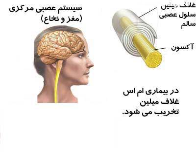  ام اس؛ وحشت دنیای مدرن 