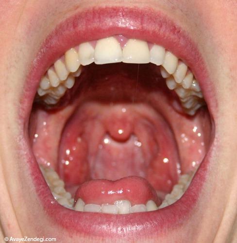 9 بیماری که دهانتان نشان می دهد 