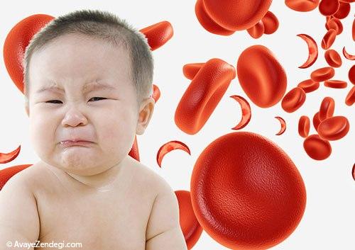 نکات مهمی درباره کم خونی در مادران و کودکان